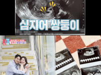 '동상이몽2' 레이디제인♥임현태, 쌍둥이 공개에 좌절…"동반입덧도" 기사의 썸네일